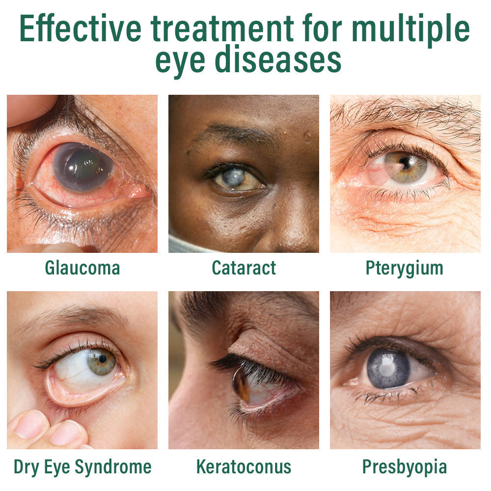 👩‍⚕️Tiworld™ Nano Eye Drops Serum ✅FDA Approved(Suitable for presbyopia, dry eye syndrome, glaucoma, and cataracts) 👀