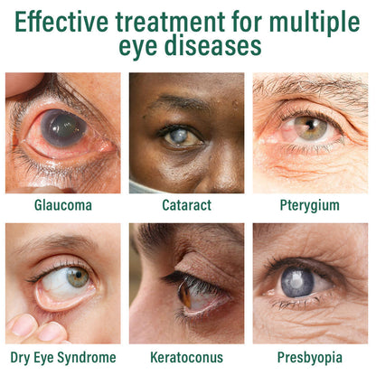 👩‍⚕️Tiworld™ Nano Eye Drops Serum ✅FDA Approved(Suitable for presbyopia, dry eye syndrome, glaucoma, and cataracts) 👀